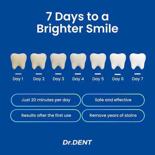 🦷 
Kit de Blanchiment des Dents Portable à LED – Usage à Domicile & en Voyage